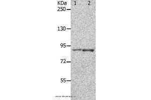 Western blot analysis of 293T cell and mouse brain tissue, using KCNC3 Polyclonal Antibody at dilution of 1:300 (KCNC3 抗体)
