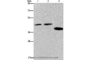 Western blot analysis of Hela, 293T and LO2 cell, using SERPINB3 Polyclonal Antibody at dilution of 1:400 (SERPINB3 抗体)