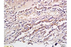 Immunohistochemistry (Paraffin-embedded Sections) (IHC (p)) image for anti-CD1a (CD1a) (AA 151-250) antibody (ABIN704096)