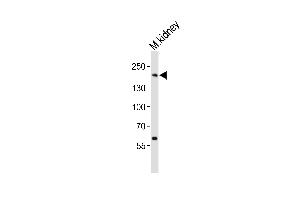 Western blot analysis of lysate from mouse kidney tissue lysate, using Erbb2 Antibody  (ABIN6243606 and ABIN6577675). (ErbB2/Her2 抗体  (AA 1142-1176))