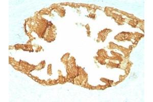 Formalin paraffin rat oviduct with Basic Cytokeratin antibody (KRTH/1076). (Keratin Basic 抗体)