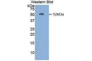 Western blot analysis of the recombinant protein. (CHGB 抗体  (AA 309-484))
