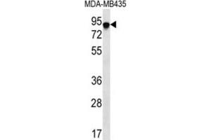 Western Blotting (WB) image for anti-FYN-Binding Protein (FYB) antibody (ABIN2996649) (FYB 抗体)