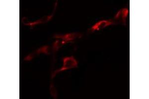 ABIN6274624 staining Hela cells by IF/ICC. (COL6A2 抗体  (Internal Region))