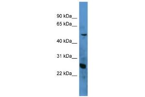 WB Suggested Anti-C1QA Antibody Titration: 0. (C1QA 抗体  (N-Term))