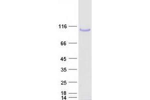 Western Blotting (WB) image for Procollagen-Lysine 2-Oxoglutarate 5-Dioxygenase 2 (PLOD2) (Transcript Variant 1) protein (Myc-DYKDDDDK Tag) (ABIN2729193)