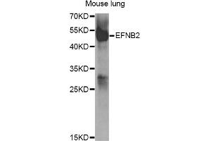 Western blot analysis of extracts of mouse lung, using EFNB2 antibody (ABIN5973311) at 1/1000 dilution. (Ephrin B2 抗体)