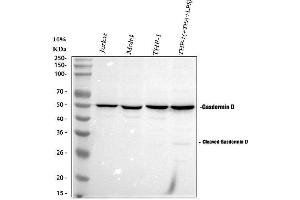 Western blot analysis of GSDMD using anti-GSDMD antibody (ABIN7599431).
