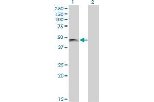 Western Blot analysis of PHF7 expression in transfected 293T cell line by PHF7 monoclonal antibody (M13), clone 3F3. (PHF7 抗体  (AA 258-357))