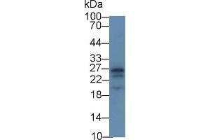 Detection of APOA1 in Rat Cerebrum lysate using Monoclonal Antibody to Apolipoprotein A1 (APOA1) (APOA1 抗体  (AA 122-267))