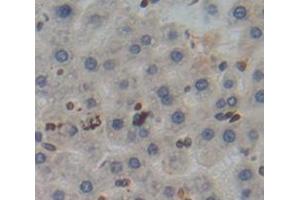 Used in DAB staining on fromalin fixed paraffin- embedded Kidney tissue (Poliovirus Receptor 抗体  (AA 22-255))