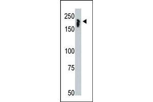 Image no. 1 for anti-Nuclear Receptor Co-Repressor 1 (NCOR1) (N-Term) antibody (ABIN356671) (NCOR1 抗体  (N-Term))
