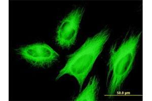 Immunofluorescence of monoclonal antibody to TUBB2A on HeLa cell. (TUBB2A 抗体  (AA 1-445))