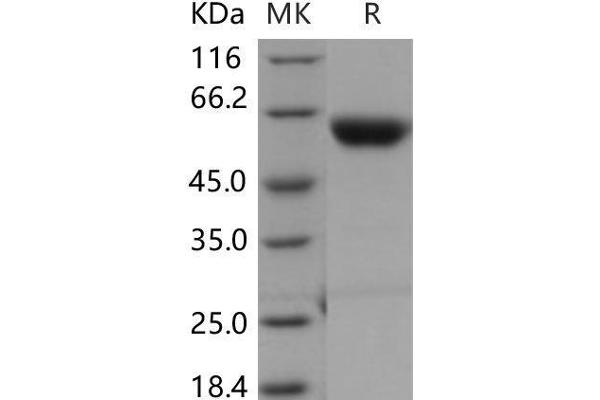 CPB2 Protein (His tag)