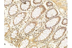 ABIN6256347 and ABIN6267658 at 1/100 staining Human normal tissues adjacent to colorectal cancer by IHC-P. (SMAD2 抗体  (pSer467))