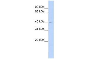 ASAHL antibody used at 1 ug/ml to detect target protein. (NAAA 抗体  (Middle Region))