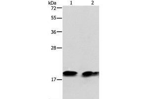 Western Blot analysis of Mouse brain tissue and NIH/3T3 cell using SKP1 Polyclonal Antibody at dilution of 1:550 (SKP1 抗体)