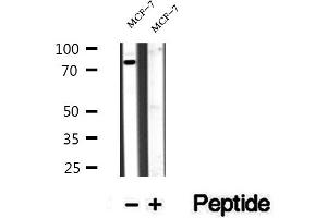 Western blot analysis of extracts of MCF-7 cells, using BBS10 antibody. (BBS10 抗体  (Internal Region))