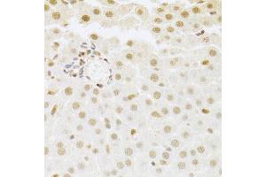 Immunohistochemistry of paraffin-embedded rat liver using SFN Antibody. (14-3-3 sigma/SFN 抗体  (AA 1-248))