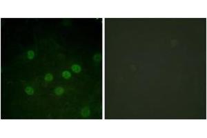 Immunofluorescence analysis of HuvEc cells treated with serum 20% 30', using Histone H1 (Phospho-Thr17) Antibody. (Histone H1 抗体  (pSer17))