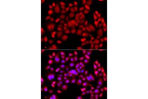 Immunofluorescence analysis of A549 cells using PIP4K2B antibody. (PIP4K2B 抗体)