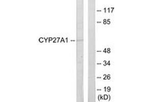 Western blot analysis of extracts from HeLa cells, using Cytochrome P450 27A1 Antibody. (CYP27A1 抗体  (AA 101-150))