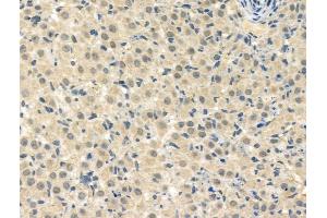 ABIN7093263 and ABIN7097282 at 1/100 staining Rat ovarian tissue by IHC-P. (HSF1 抗体  (pThr142))