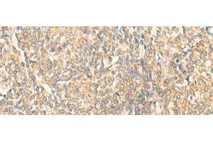 Immunohistochemistry of paraffin-embedded Human tonsil tissue using GRIA4 Polyclonal Antibody at dilution of 1:35(x200) (GRIA4 抗体)