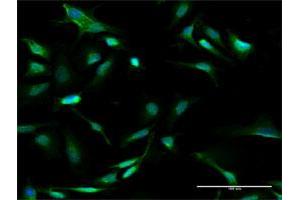 Immunofluorescence of purified MaxPab antibody to GALT on HeLa cell. (GALT 抗体  (AA 1-379))