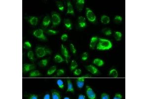 Immunofluorescence analysis of HeLa cells using GAS2 Polyclonal Antibody (GAS2 抗体)