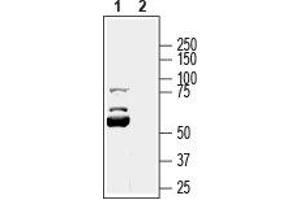 KCNK16 抗体  (1st Extracellular Loop)