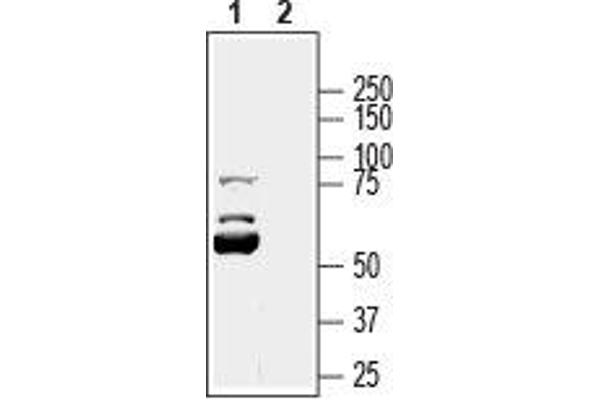 KCNK16 抗体  (1st Extracellular Loop)