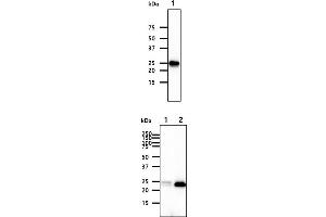 The cell lysates (40ug) were resolved by SDS-PAGE, transferred to PVDF membrane and probed with anti-human FKBP14 antibody (1:1000). (FKBP14 抗体)