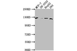 Western Blot Positive WB detected in: MCF-7 whole cell lysate, SH-SY5Y whole cell lysate, HepG2 whole cell lysate, 293 whole cell lysate All lanes: WWC3 antibody at 1:1000 Secondary Goat polyclonal to rabbit IgG at 1/50000 dilution Predicted band size: 123, 66 kDa Observed band size: 123 kDa (WWC3 抗体  (AA 65-85))