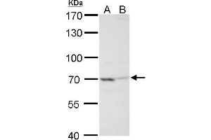 WB Image TNF alpha IP2 antibody detects TNF alpha IP2 protein by Western blot analysis. (TNIP2 抗体  (Center))