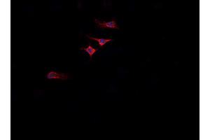 ABIN6268874 staining  A549 cells by IF/ICC. (Integrin beta 5 抗体)