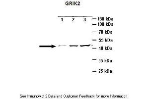 Lanes:   Lane1: 10ug mouse cortex brain lysate Lane2: 25ug mouse cortex brain lysate Lane3: 40ug mouse cortex brain lysate  Primary Antibody Dilution:   1:1000  Secondary Antibody:   Anti-rabbit HRP  Secondary Antibody Dilution:   1:2000  Gene Name:   GRIK2  Submitted by:   Anonymous (GRIK2 抗体  (N-Term))