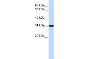WB Suggested Anti-RPA4 Antibody Titration: 0. (RPA4 抗体  (Middle Region))