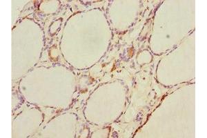 Immunohistochemistry of paraffin-embedded human thyroid tissue using ABIN7164417 at dilution of 1:100 (DTX2 抗体  (AA 1-280))