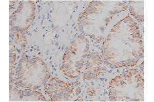 Immunohistochemistry (IHC) image for anti-Synuclein, alpha (SNCA) (pSer129) antibody (ABIN6254965)