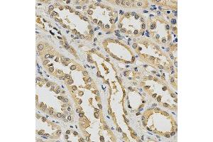 Immunohistochemistry of paraffin-embedded human kidney using PDGFRB antibody at dilution of 1:200 (x400 lens) (PDGFRB 抗体)