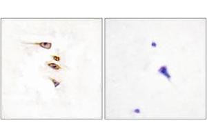 Immunohistochemistry analysis of paraffin-embedded human brain tissue, using EPHA6 Antibody. (EPH Receptor A6 抗体  (AA 891-940))