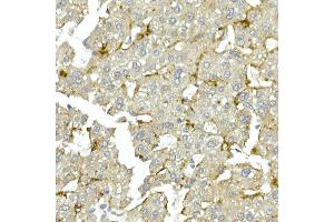 Immunohistochemistry (IHC) image for anti-Cyclin-Dependent Kinase 1 (CDK1) antibody (ABIN7266576)