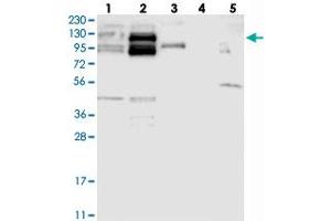 Western blot analysis of Lane 1: RT-4, Lane 2: U-251 MG, Lane 3: Human Plasma, Lane 4: Liver, Lane 5: Tonsil with CYTSB polyclonal antibody . (NSP5 抗体)