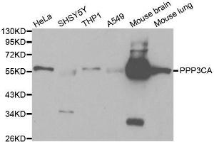 Western blot analysis of extracts of various cell lines, using PPP3CA antibody. (PPP3CA 抗体  (AA 1-511))