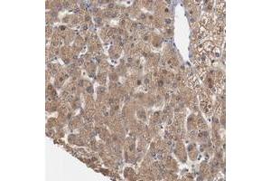 Immunohistochemical staining of human liver with ERICH1 polyclonal antibody  shows cytoplasmic positivity in hepatocytes at 1:20-1:50 dilution. (ERICH1 抗体)