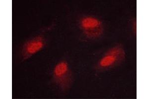 ABIN6267669 staining HeLa cells by ICC/IF. (CAMK4 抗体  (pThr200))