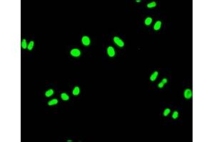 Immunofluorescence staining of Hela Cells with ABIN7127503 at 1:50, counter-stained with DAPI. (Recombinant FUBP1 抗体)