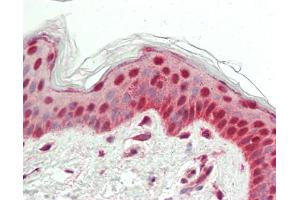 Immunohistochemistry (Paraffin-embedded Sections) (IHC (p)) image for anti-Cleavage and Polyadenylation Specific Factor 3, 73kDa (CPSF3) (AA 1-50) antibody (ABIN2619490)