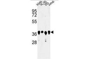 Western blot analysis of ARGLU1 Antibody (N-term) in A549, HL-60, 293, Jurkat cell line lysates (35µg/lane). (ARGLU1 抗体  (N-Term))